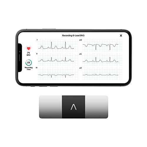 KardiaMobile 6-Lead Personal EKG Monitor – Six Views of The