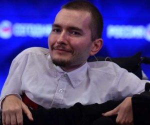 The first head transplant in history will be held in December 2017