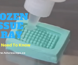 Frozen Tissue Arrays: All You Need To Know About This Technique