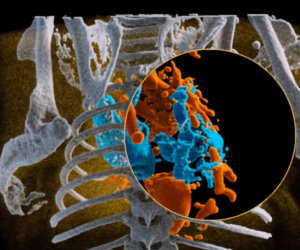 CERN Scientists Just Release 3D Color X-Ray Images Technology of The Human Body